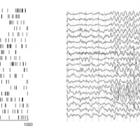 Decoding Analyses to Understand Neural Content and Coding