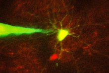 Image: Ho-Jun Suk - In this image, a pipette guided by a robotic arm approaches a neuron identified with a fluorescent stain.  